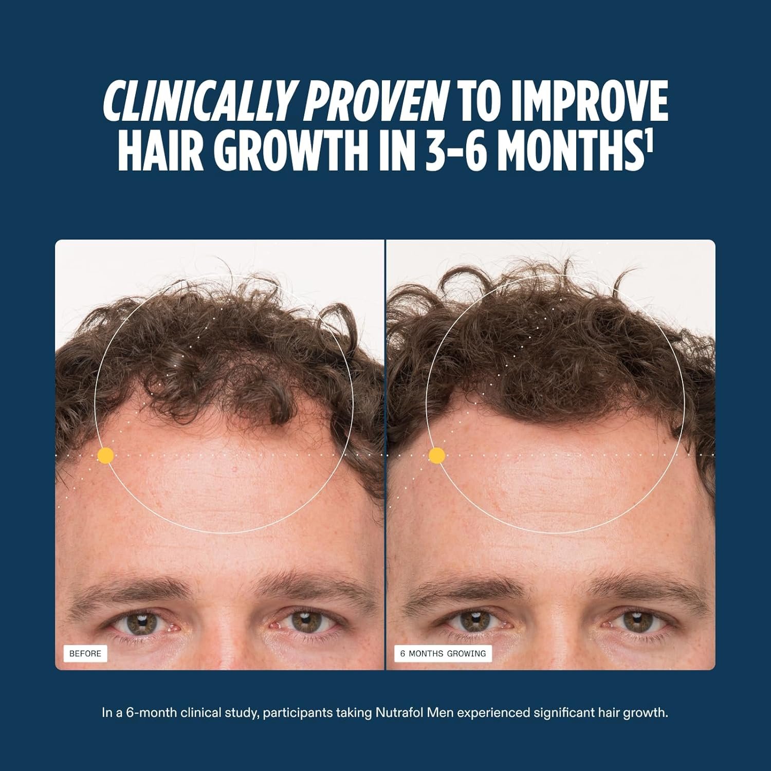 Nutrafol Men’s Hair Growth Supplements – 1-Month Supply for Visibly Thicker Hair & Improved Scalp Coverage - Image 4
