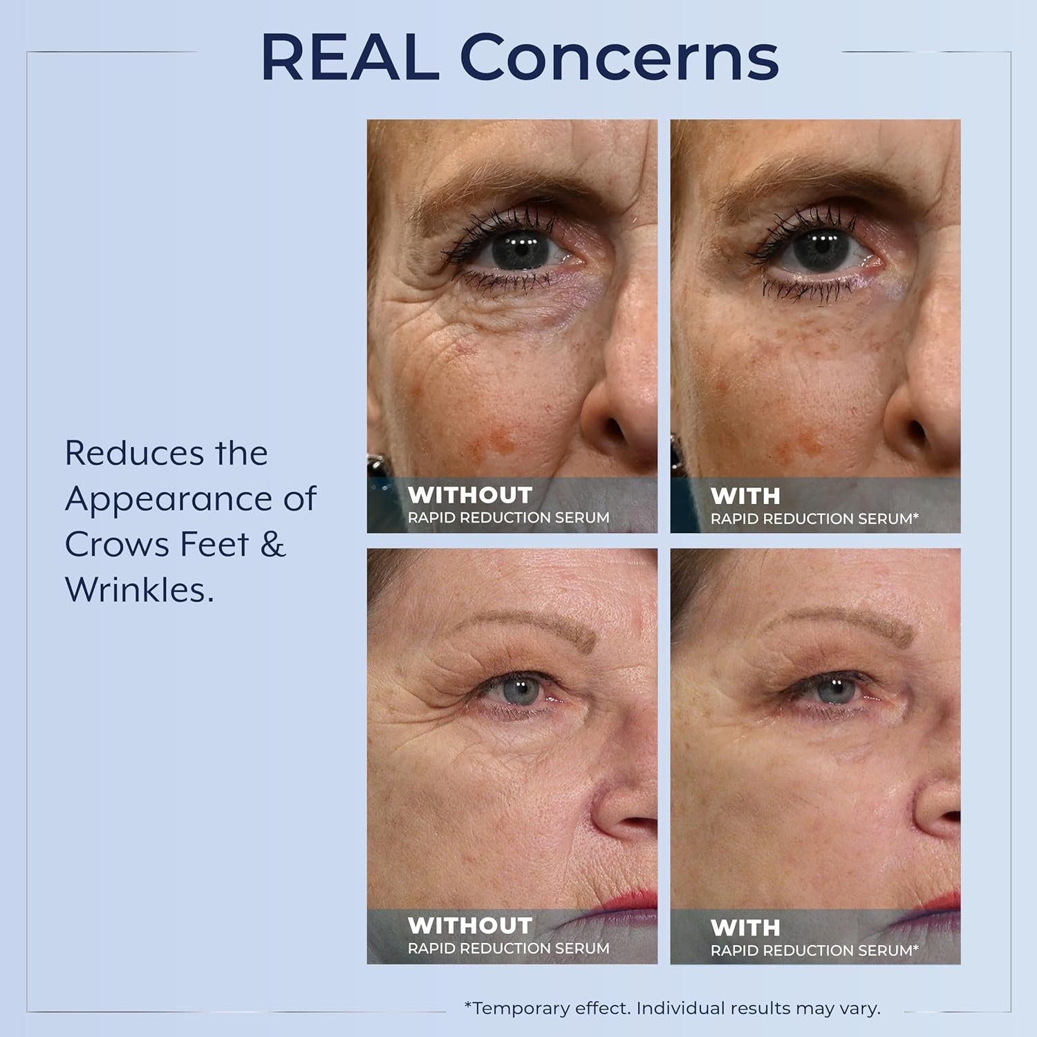 Plexaderm Rapid Reduction Eye Serum – Temporary Under-Eye Smoothing Serum for Bags, Fine Lines, Wrinkles, Dark Circles & Crow’s Feet – Pump - Image 4