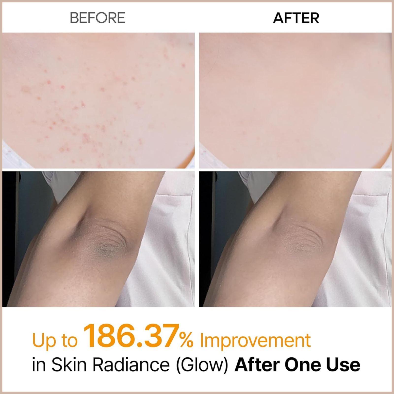 Kojic Acid & Turmeric Exfoliating Body Spray for Brightening, Nourishing & Skin Renewal - Image 2