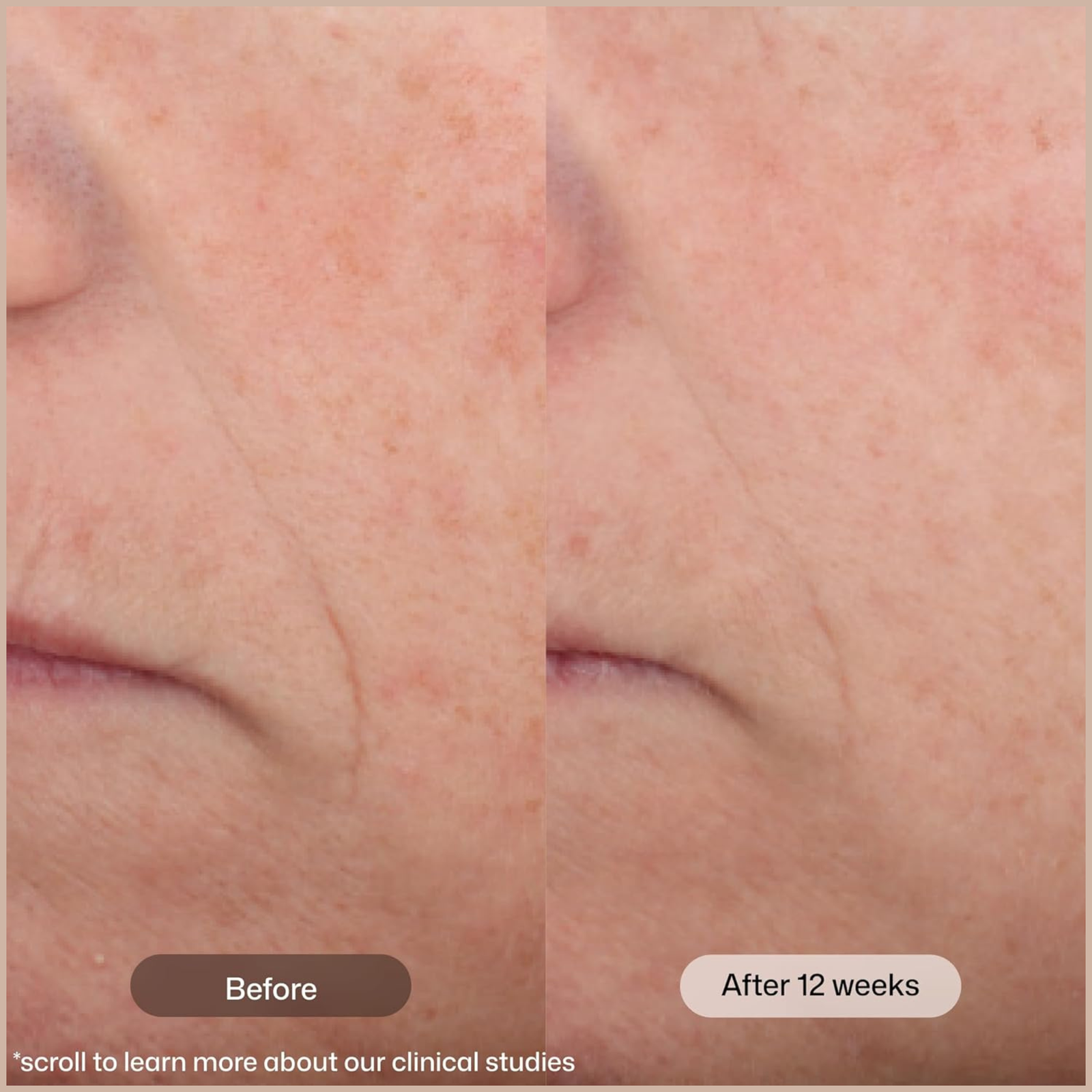 Tinted Face Moisturizer SPF 45 with Peptides & Vitamin C for Anti-Aging, Brightening & Hydration - Image 3