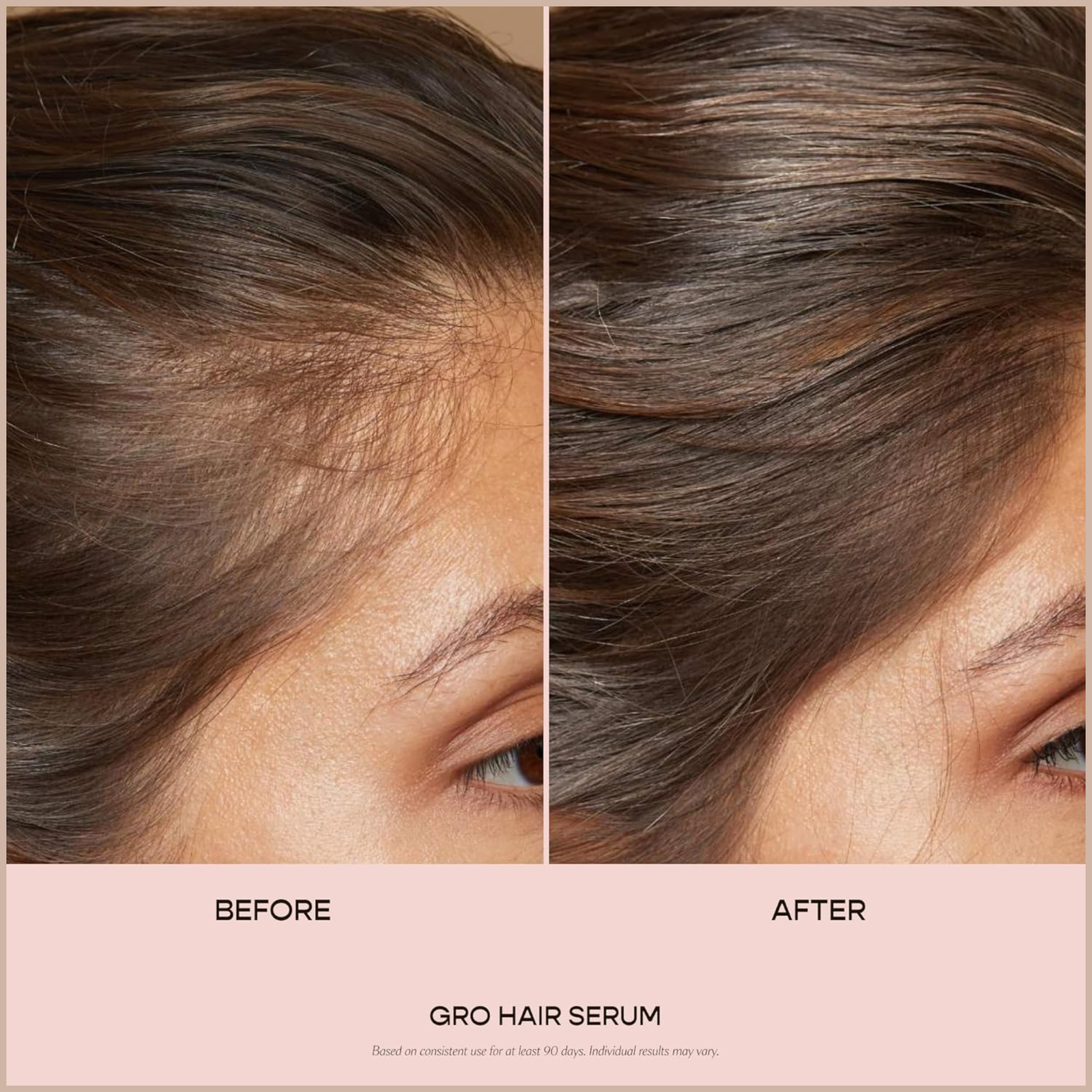 Scalp & Hair Growth Serum – Thicker, Fuller-Looking Hair Support for All Hair Types - Image 4