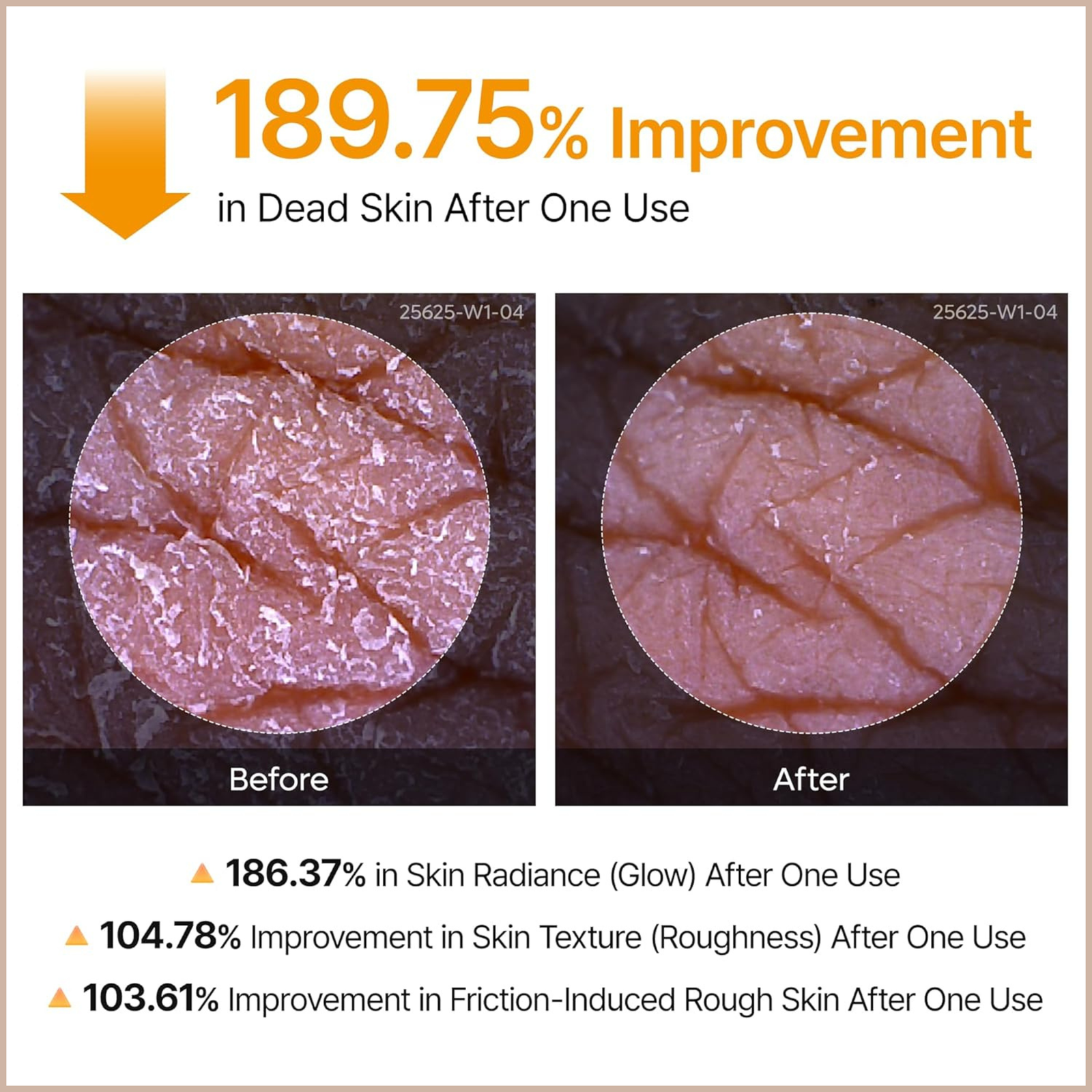 Kojic Acid & Turmeric Exfoliating Body Spray for Brightening, Nourishing & Skin Renewal - Image 5