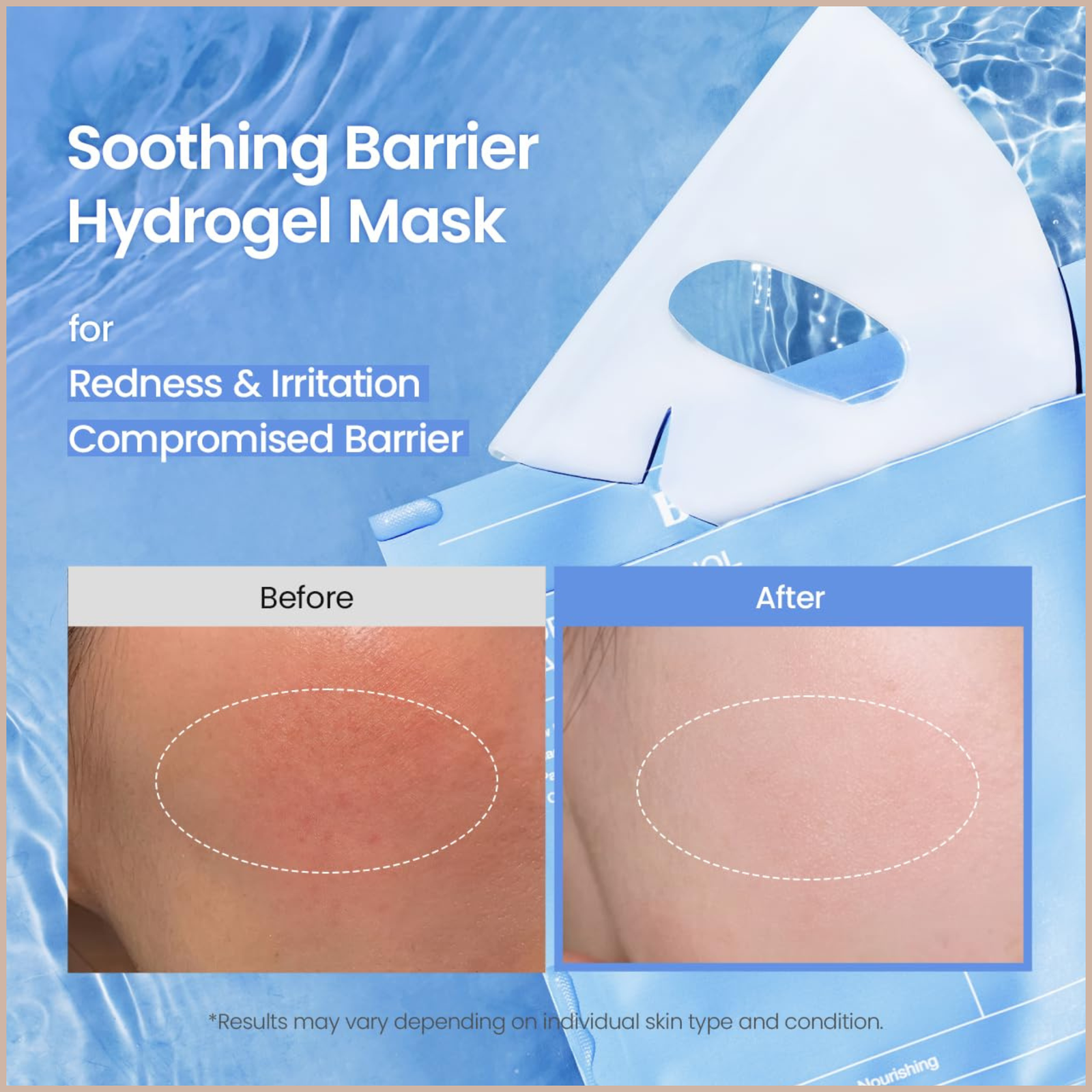 Hydrogel Sheet Mask for Hydration, Soothing & Skin Barrier Care - Image 10